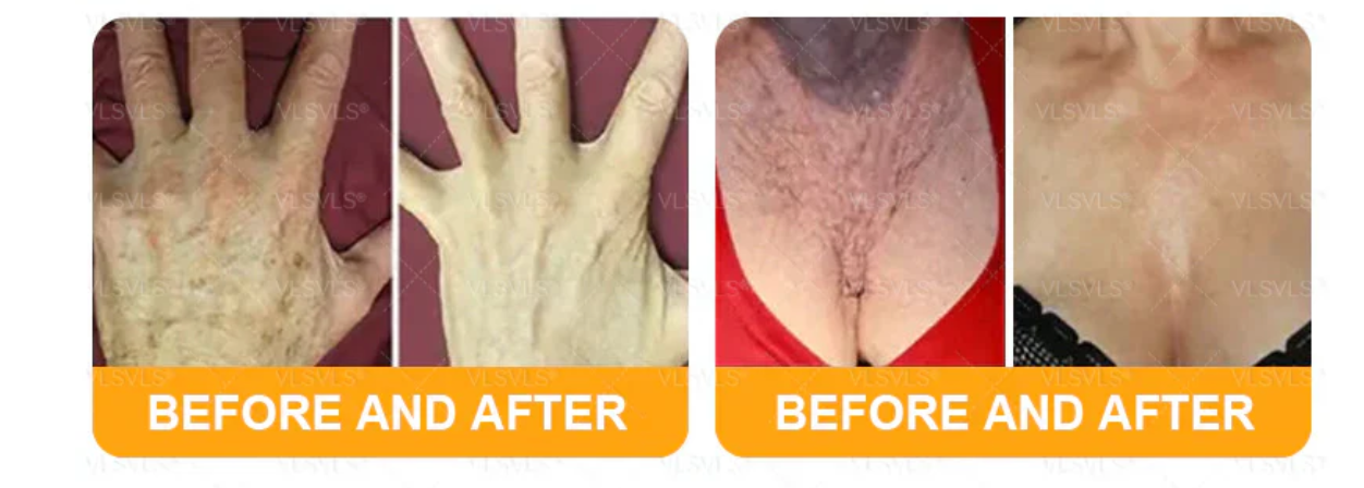 Senzio Balm Application Before & After Part 2